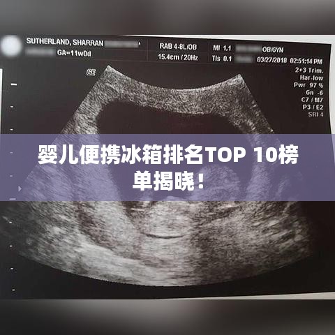 嬰兒便攜冰箱排名TOP 10榜單揭曉！