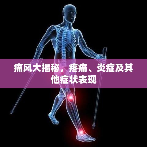 痛風(fēng)大揭秘，疼痛、炎癥及其他癥狀表現(xiàn)