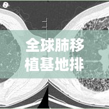 沒張倒置